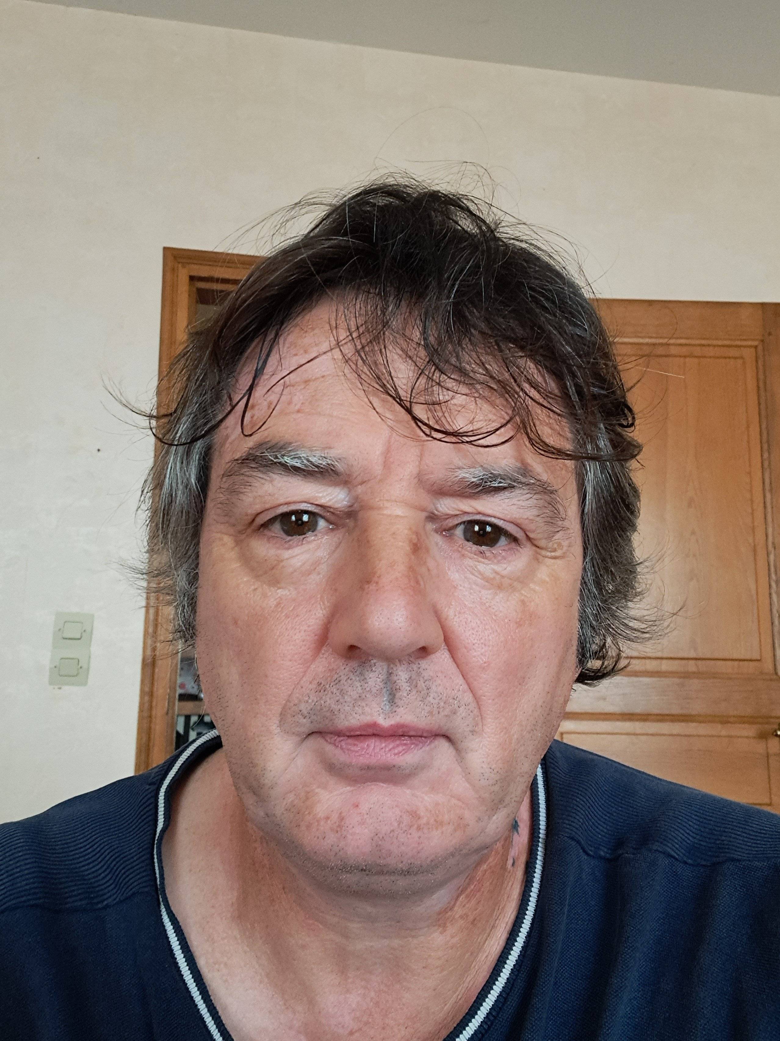 Alain